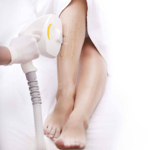 epilation definitive laser jambes marseille 1